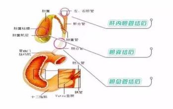 不用再因脑肿瘤而烦恼 早发现早治疗是关键